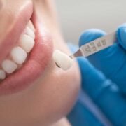 How Dental Crowns Can Transform Your Smile