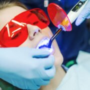 The Future of Your Smile: Lasers in Dentistry