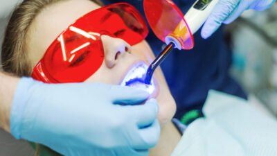 The Future of Your Smile: Lasers in Dentistry